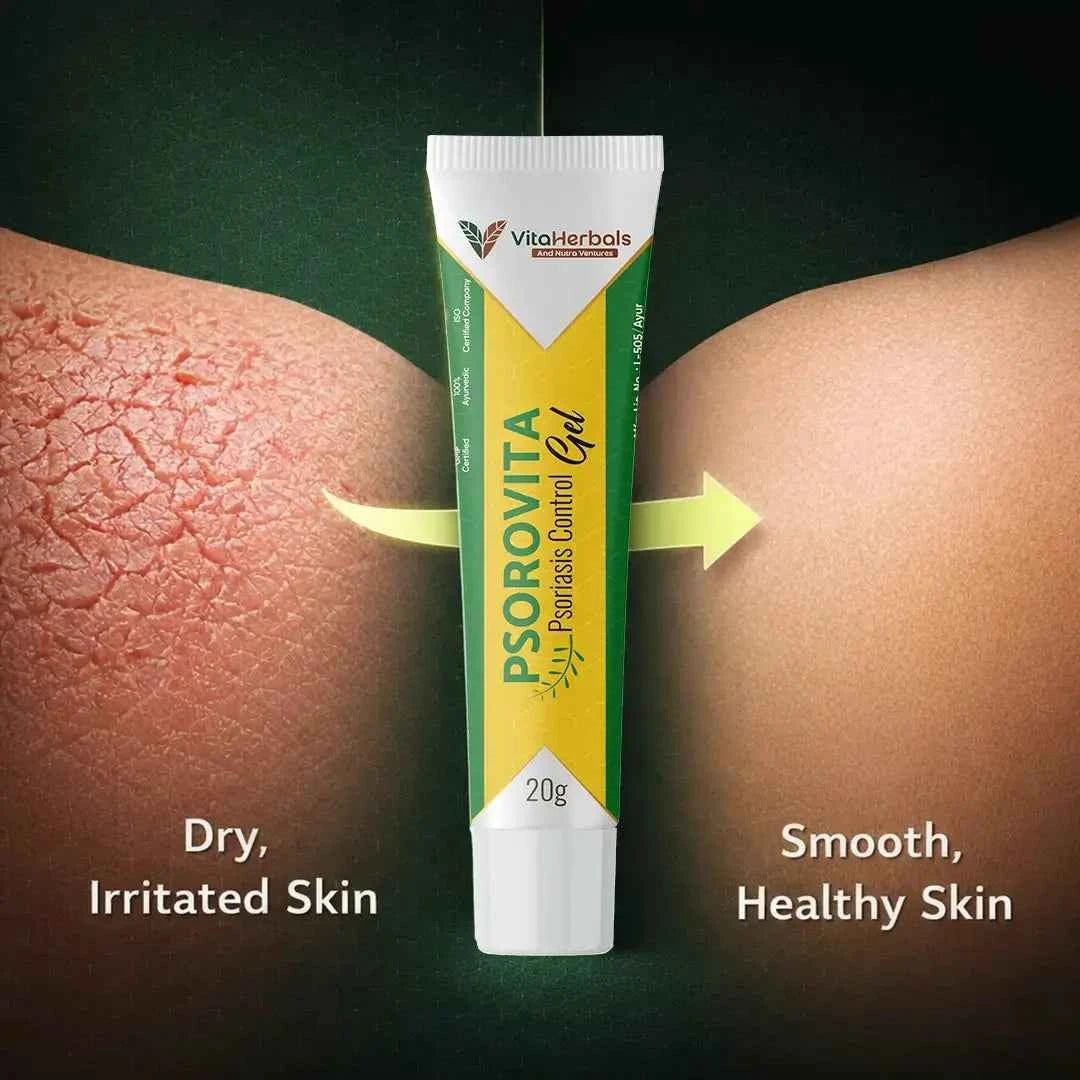 Psorovita Gel