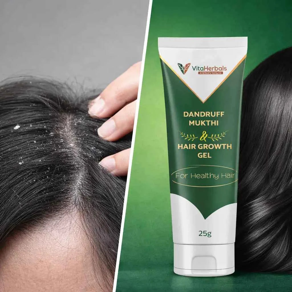 Dandruff Mukthi Gel